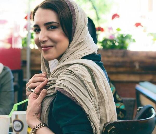 عکس سحر جعفری جوزانی بعد از بوتاکس