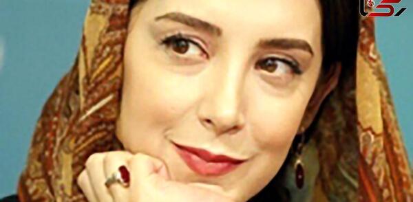 عکس سحر جعفری جوزانی بعد از بوتاکس