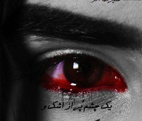 عکس چشم گریه طبیعی