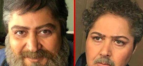 عکسهای شهره لرستانی بعد از عمل