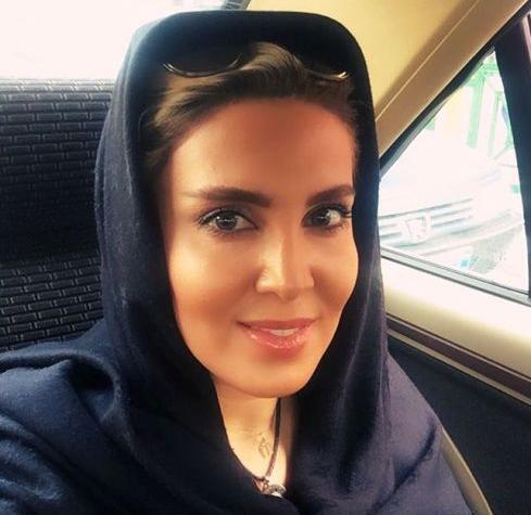عکس لیلا بلوکات قبل از عمل زیبایی