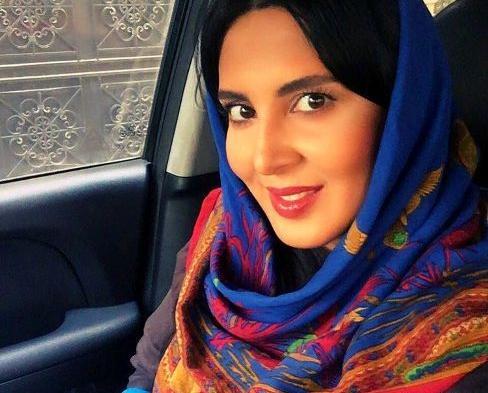 عکس لیلا بلوکات قبل از عمل زیبایی
