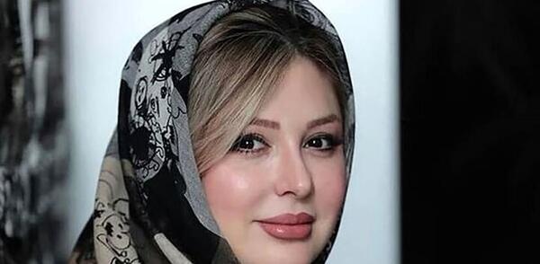 عکس بافت مو نیوشا ضیغمی