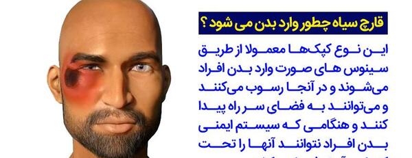 عکس کرونا قارچی