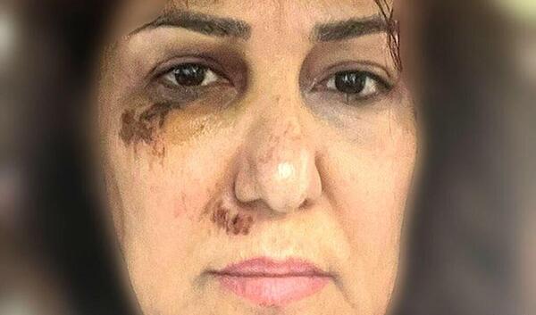 عکس ضرب و شتم