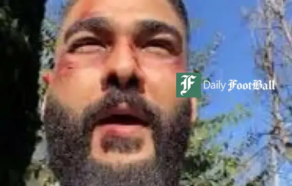 عکس ضرب و شتم