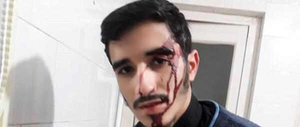 عکس ضرب و شتم