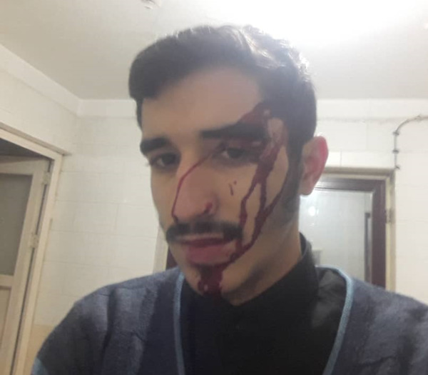 عکس ضرب و شتم