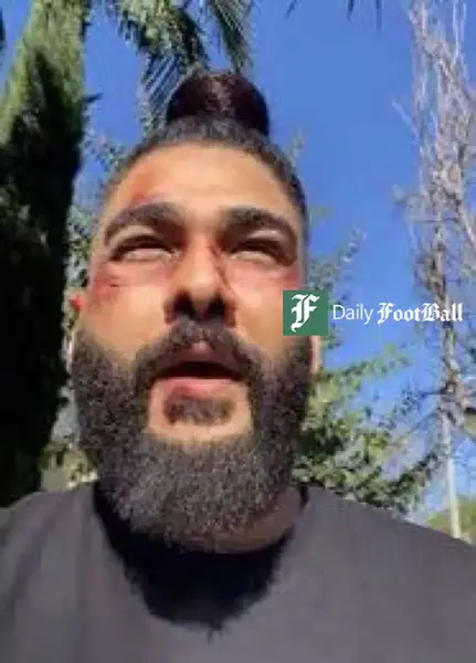 عکس ضرب و شتم
