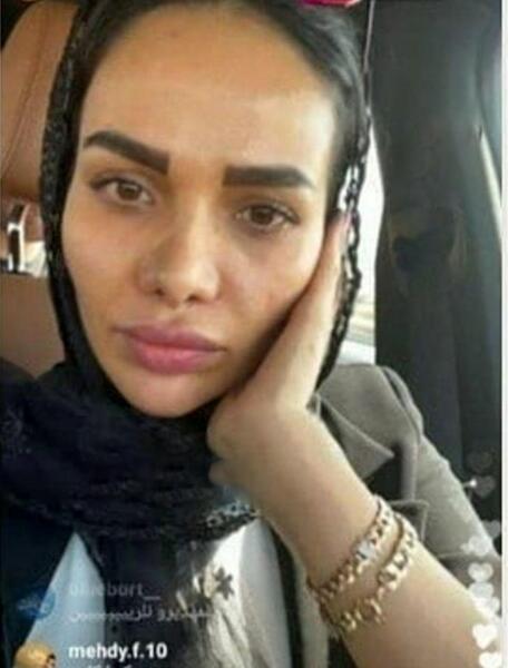 عکس مهدی قائدی با ریش