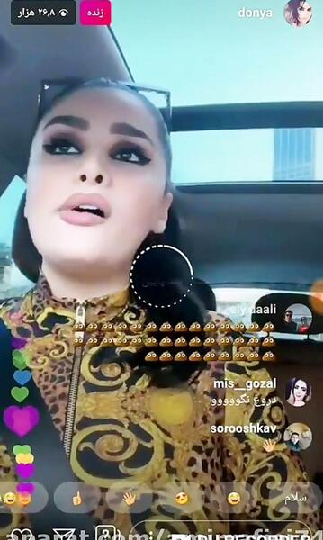 عکس کچل دنیا جهانبخت