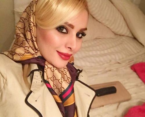 عکس کچل دنیا جهانبخت
