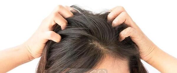 عکس شپش قهوه ای