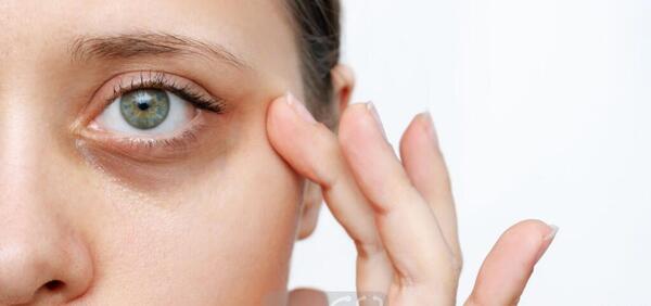 عکس شپش قهوه ای