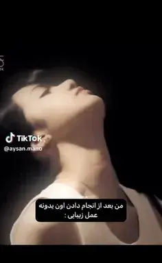 عکس قبل از عمل نیکا فلاحی