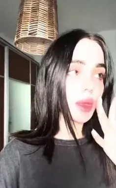 عکس قبل از عمل نیکا فلاحی