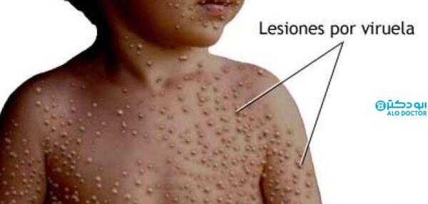 عکس ابله ی میمون