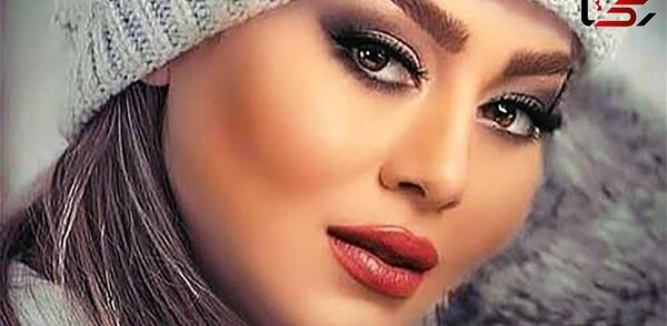 عکس سحر قریشی قبل از عمل