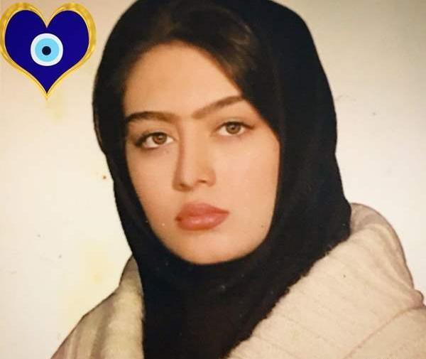 عکس سحر قریشی قبل از عمل