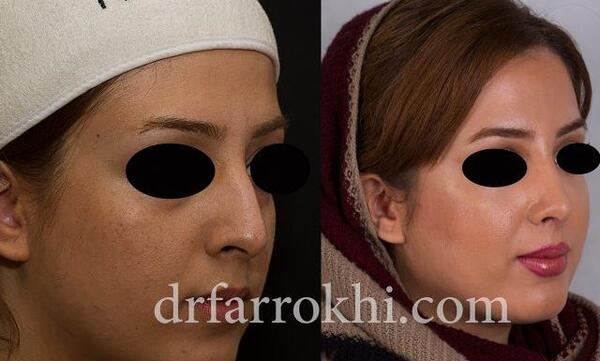 عکس دکتر بهزاد آسنجرانی
