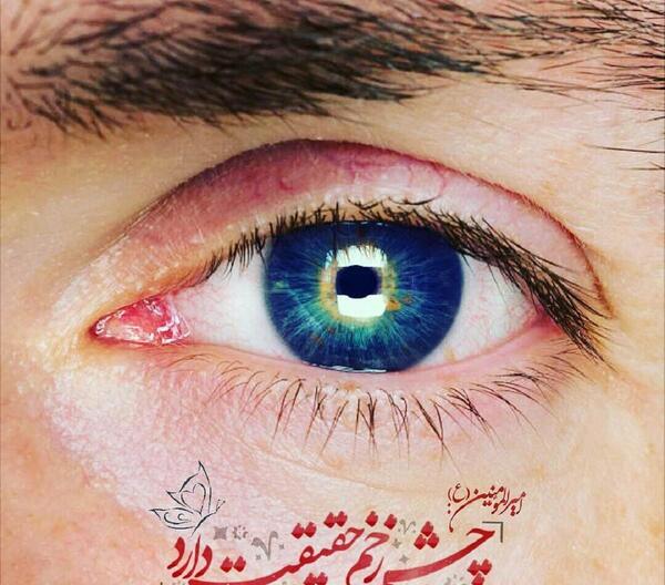 عکس چشم زخم ناخن