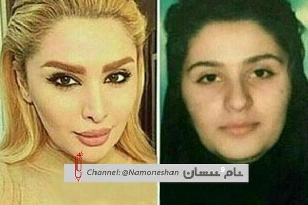 عکس دنیا جهانبخت قبل از عمل جراحی