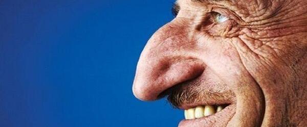 عکس دنیا جهانبخت قبل از عمل جراحی
