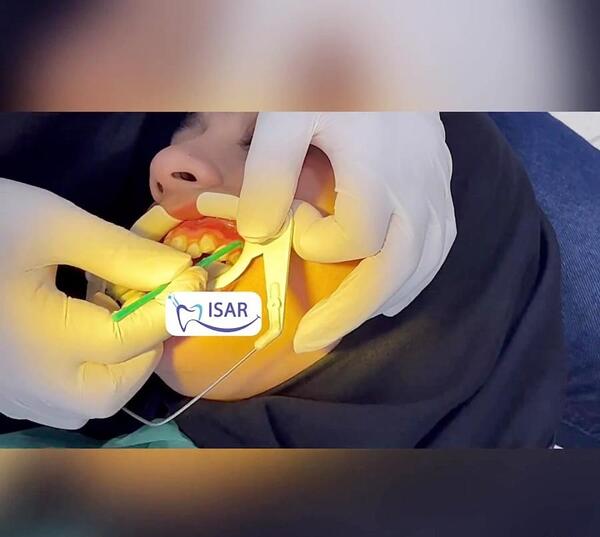عکس ماشین علی علیپور