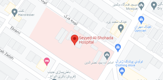 عکس چشم یزد
