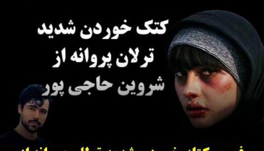 عکس سوتی ترلان پروانه