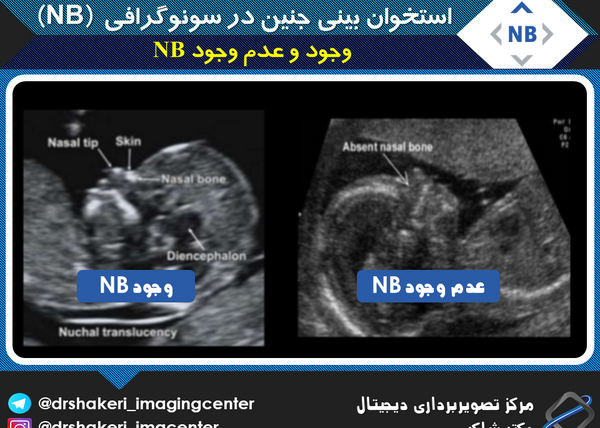 عکس اولین سونوگرافی بارداری نی نی سایت
