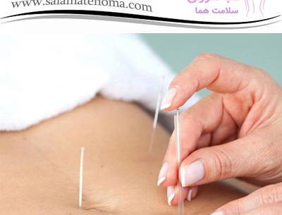 عکس گوشواره لاغری