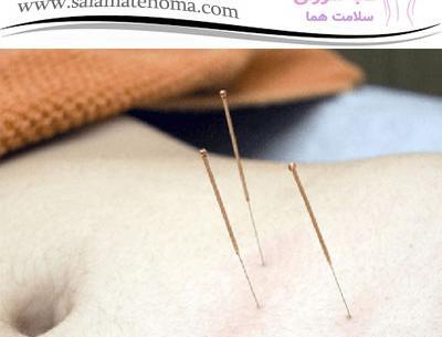 عکس گوشواره لاغری