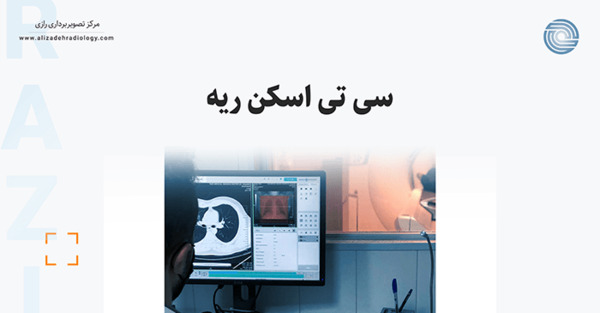 عکس اسکن ریه درگیر کرونا