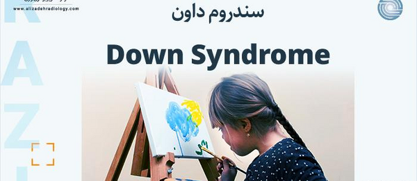 عکس اسکن ریه درگیر کرونا