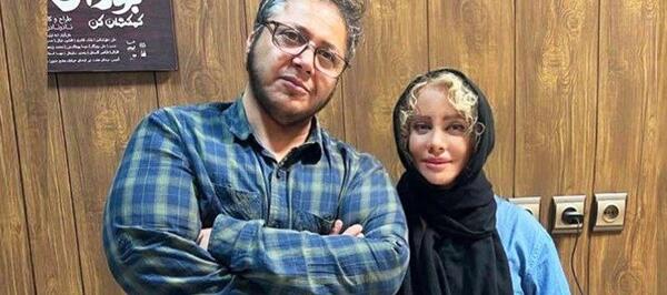 عکس شهره لرستانی قبل و بعد