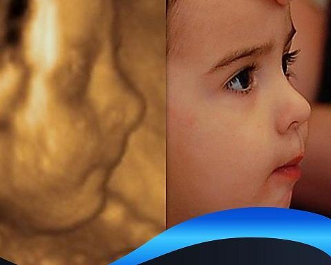 عکس سه بعدی سونوگرافی