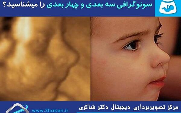 عکس سه بعدی سونوگرافی