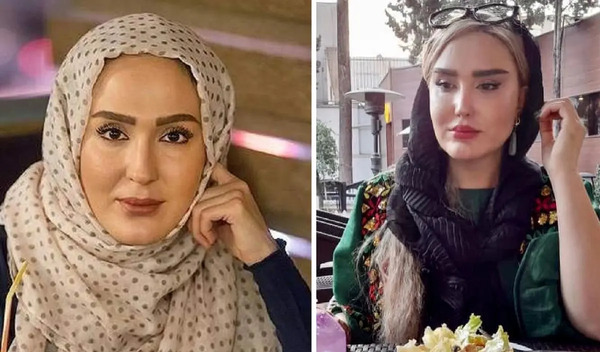 عکس زهره فکور صبور بعد از عمل