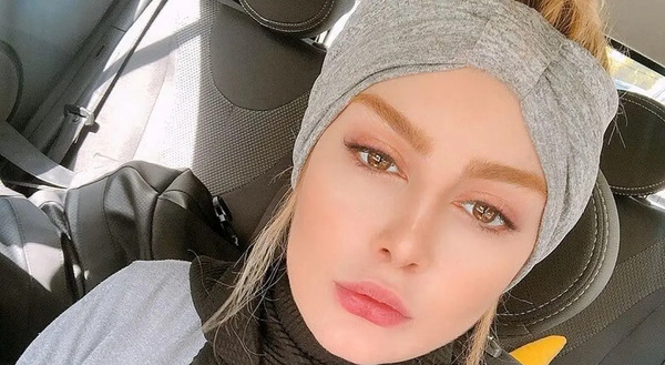 عکس قبل عمل سحر قریشی