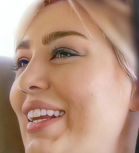 عکس قبل عمل سحر قریشی
