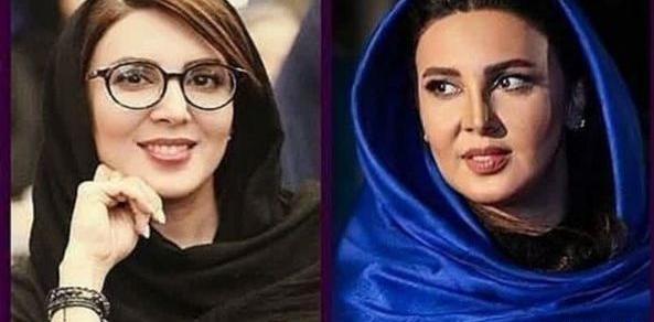 عکس لیلا بلوکات قبل از عمل