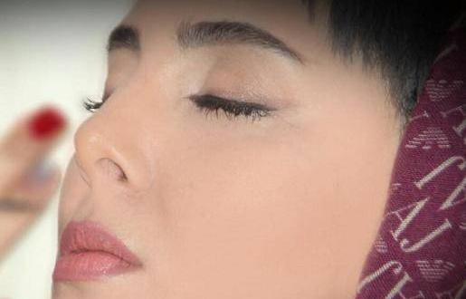 عکس لیلا بلوکات قبل از عمل