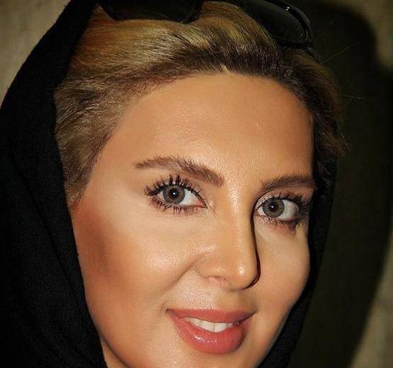 عکس لیلا بلوکات قبل از عمل