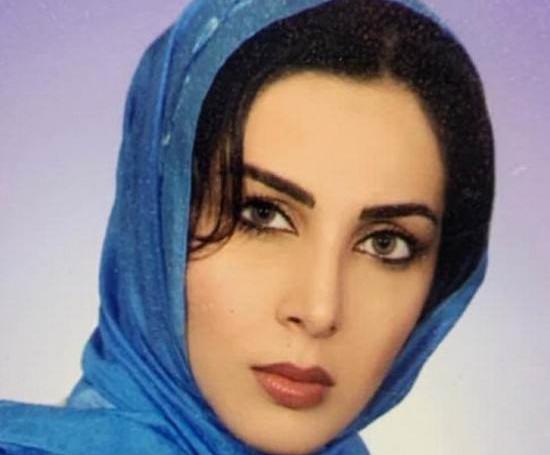 عکس لیلا بلوکات قبل از عمل