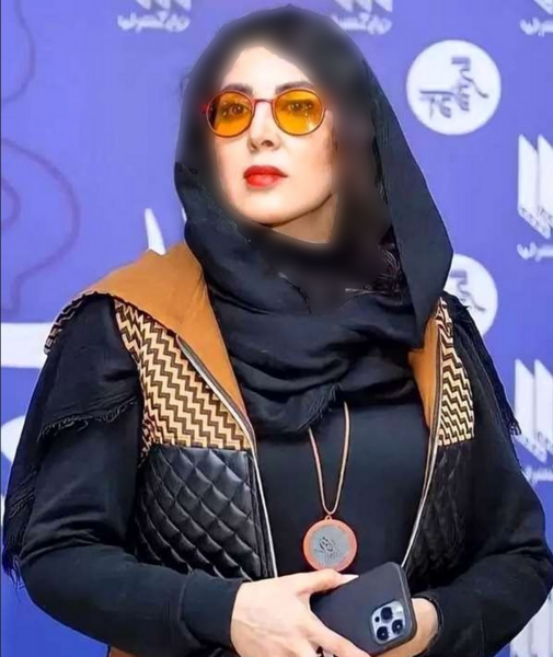 عکس لیلا بلوکات قبل از عمل