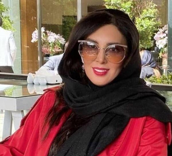 عکس لیلا بلوکات قبل از عمل