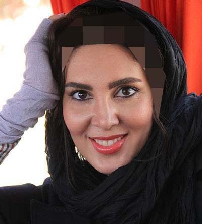 عکس لیلا بلوکات قبل از عمل