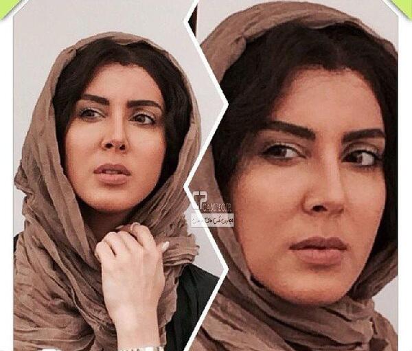 عکس لیلا بلوکات قبل از عمل