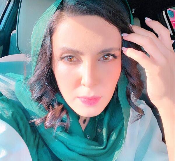 عکس لیلا بلوکات قبل از عمل